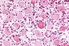 MRGPRX4 Antibody in Immunohistochemistry (Paraffin) (IHC (P))