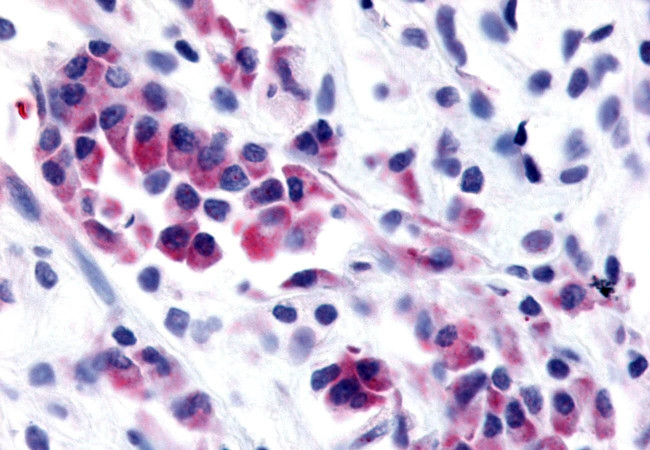 NEK9 Antibody in Immunohistochemistry (Paraffin) (IHC (P))
