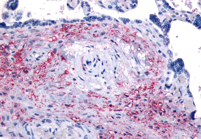 NET1 Antibody in Immunohistochemistry (Paraffin) (IHC (P))