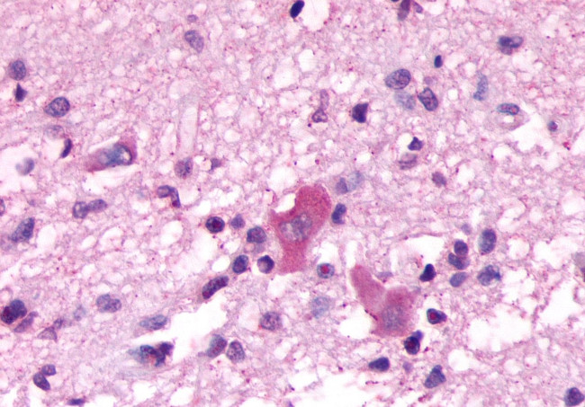 NMBR Antibody in Immunohistochemistry (Paraffin) (IHC (P))