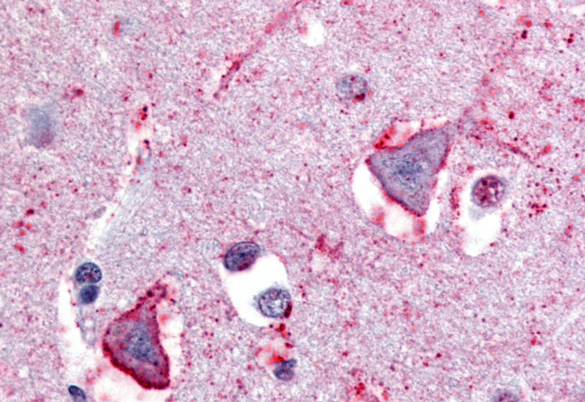 NPBWR1 Antibody in Immunohistochemistry (Paraffin) (IHC (P))