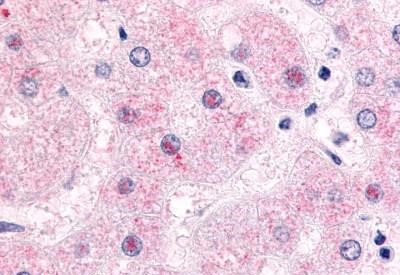 NR0B2 Antibody in Immunohistochemistry (Paraffin) (IHC (P))