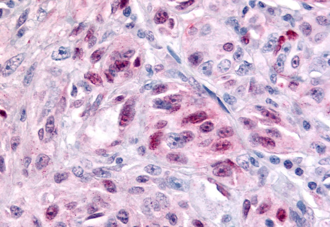 NR1D2 Antibody in Immunohistochemistry (Paraffin) (IHC (P))