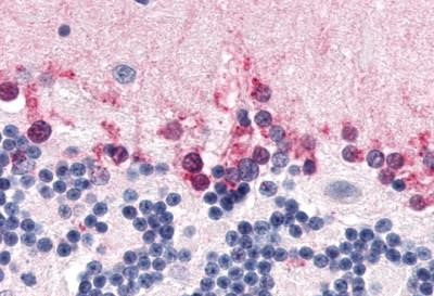 NR1D2 Antibody in Immunohistochemistry (Paraffin) (IHC (P))