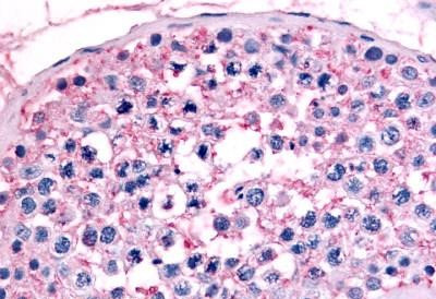 GCNF Antibody in Immunohistochemistry (Paraffin) (IHC (P))