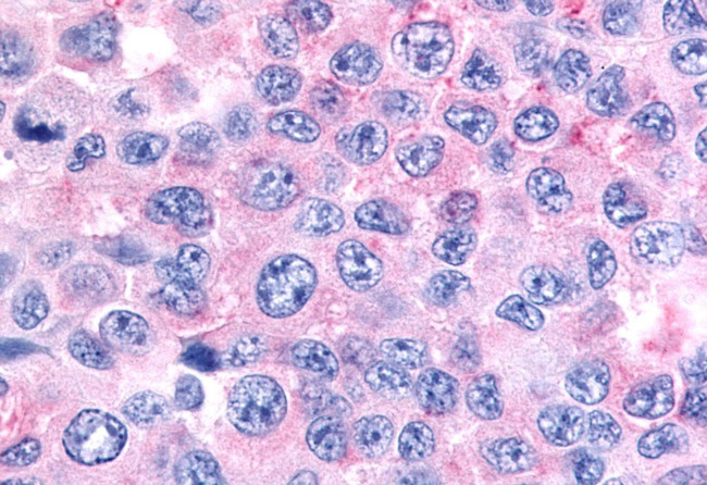 GCNF Antibody in Immunohistochemistry (Paraffin) (IHC (P))