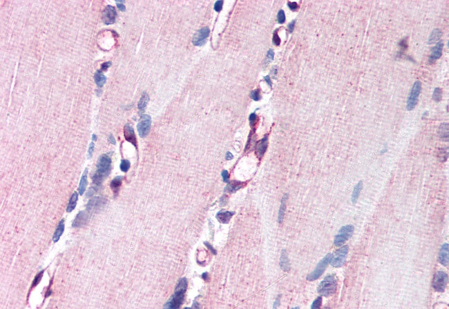 NRG1 Antibody in Immunohistochemistry (Paraffin) (IHC (P))