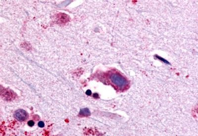 NTSR1 Antibody in Immunohistochemistry (Paraffin) (IHC (P))