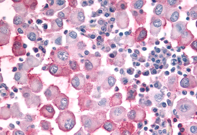 OR10J5 Antibody in Immunohistochemistry (Paraffin) (IHC (P))