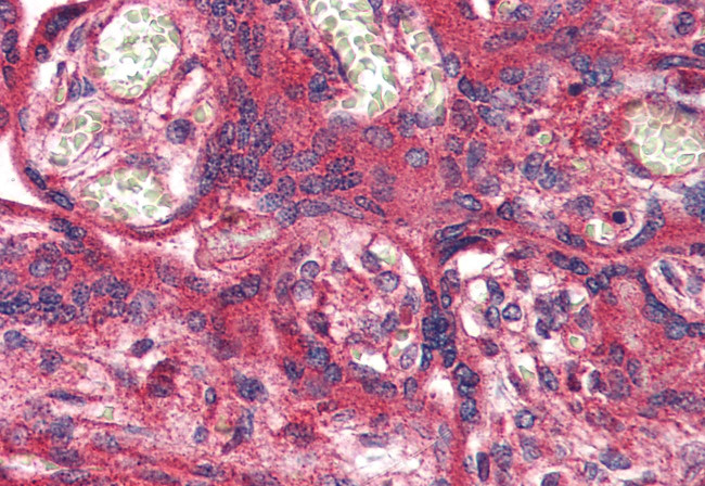 OR51E1 Antibody in Immunohistochemistry (Paraffin) (IHC (P))