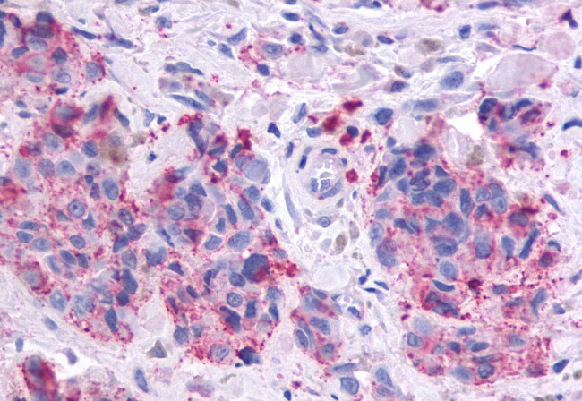 OR51E1 Antibody in Immunohistochemistry (Paraffin) (IHC (P))