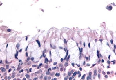OR6K3 Antibody in Immunohistochemistry (Paraffin) (IHC (P))