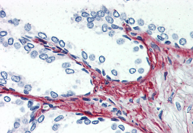 P2X3 Antibody in Immunohistochemistry (Paraffin) (IHC (P))