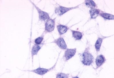 P2Y6 Antibody in Immunocytochemistry (ICC/IF)