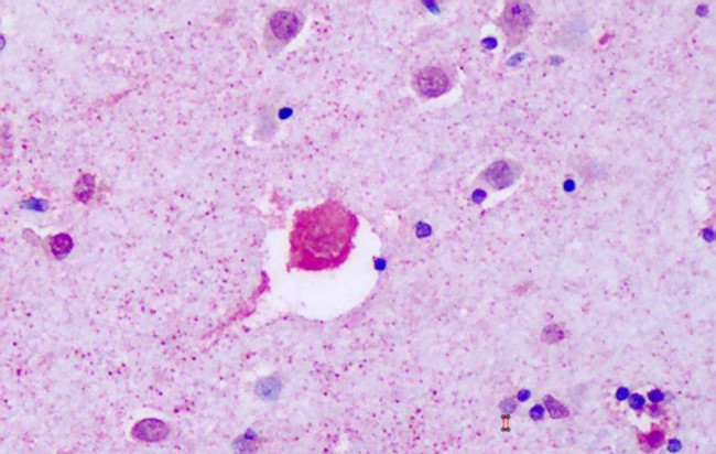 P2Y8 Antibody in Immunohistochemistry (Paraffin) (IHC (P))