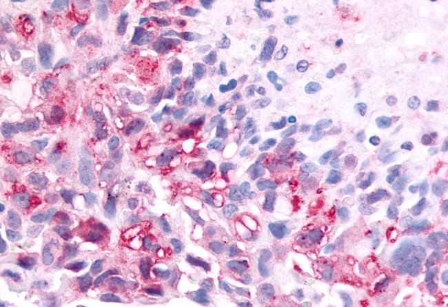PAK6 Antibody in Immunohistochemistry (Paraffin) (IHC (P))