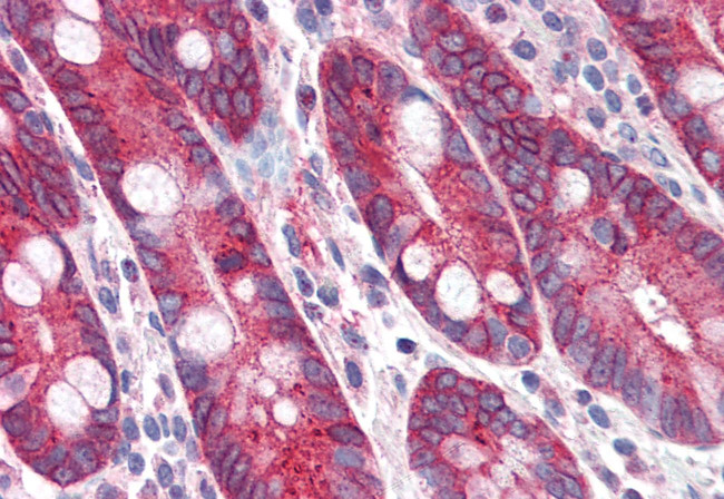 PIGR Antibody in Immunohistochemistry (Paraffin) (IHC (P))