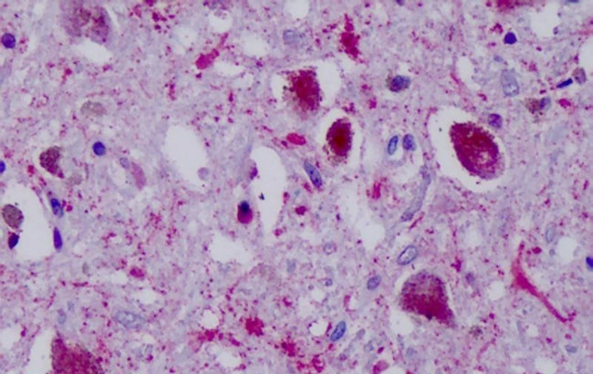 NPY4R Antibody in Immunohistochemistry (Paraffin) (IHC (P))