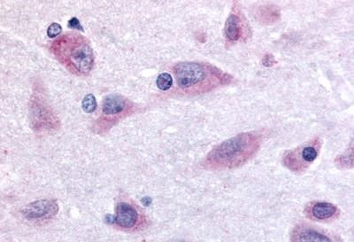 Prokineticin Receptor 2 Antibody in Immunohistochemistry (Paraffin) (IHC (P))