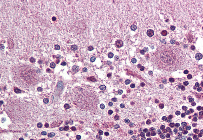 Prokineticin Receptor 2 Antibody in Immunohistochemistry (Paraffin) (IHC (P))