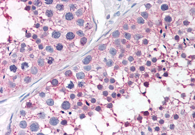 PTGES Antibody in Immunohistochemistry (Paraffin) (IHC (P))