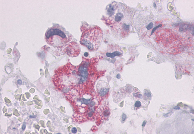 PTH1R Antibody in Immunohistochemistry (Paraffin) (IHC (P))