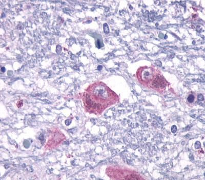 PTH2R Antibody in Immunohistochemistry (Paraffin) (IHC (P))