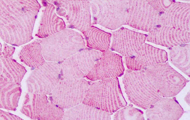 PTPRA Antibody in Immunohistochemistry (Paraffin) (IHC (P))