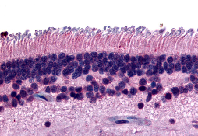 PTPRM Antibody in Immunohistochemistry (Paraffin) (IHC (P))