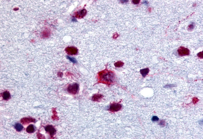 GPBB Antibody in Immunohistochemistry (Paraffin) (IHC (P))