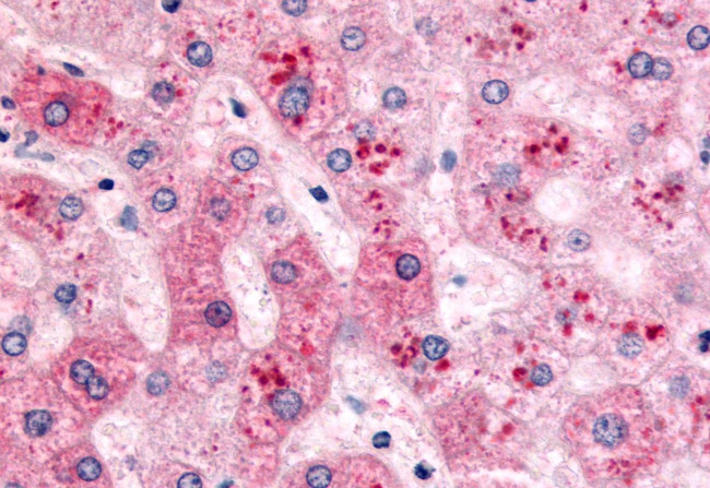 PYGL Antibody in Immunohistochemistry (Paraffin) (IHC (P))