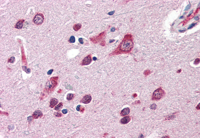 QSOX2 Antibody in Immunohistochemistry (Paraffin) (IHC (P))