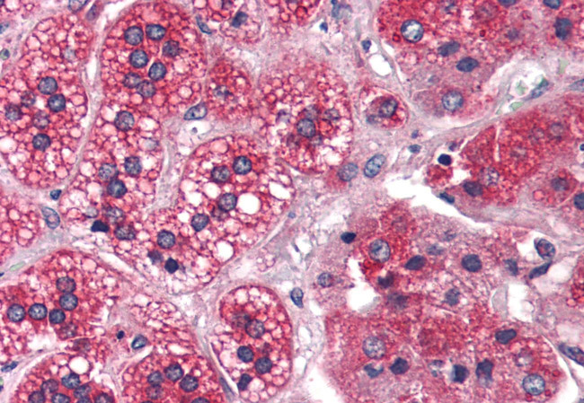 REEP5 Antibody in Immunohistochemistry (Paraffin) (IHC (P))