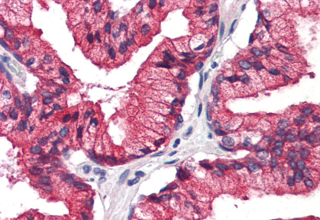 REEP5 Antibody in Immunohistochemistry (Paraffin) (IHC (P))