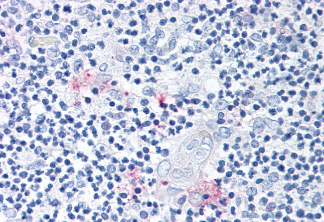 ROR gamma Antibody in Immunohistochemistry (Paraffin) (IHC (P))