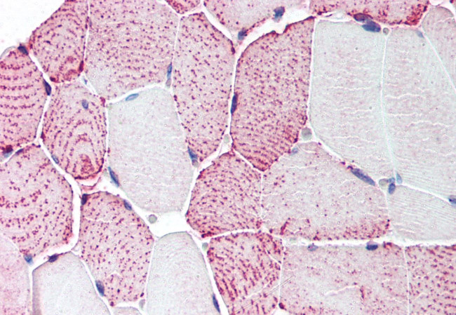 RXFP2 Antibody in Immunohistochemistry (Paraffin) (IHC (P))