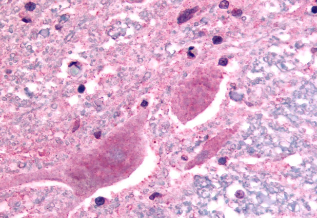 SCN3A Antibody in Immunohistochemistry (Paraffin) (IHC (P))