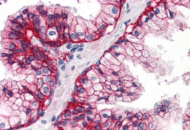 ASCT2 Antibody in Immunohistochemistry (Paraffin) (IHC (P))