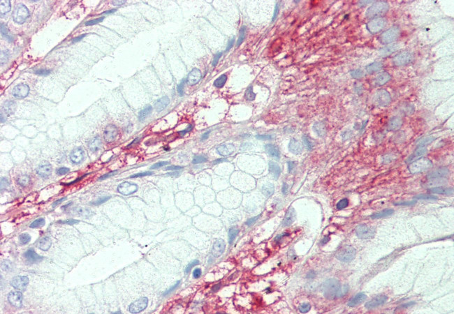 SLC7A2 Antibody in Immunohistochemistry (Paraffin) (IHC (P))