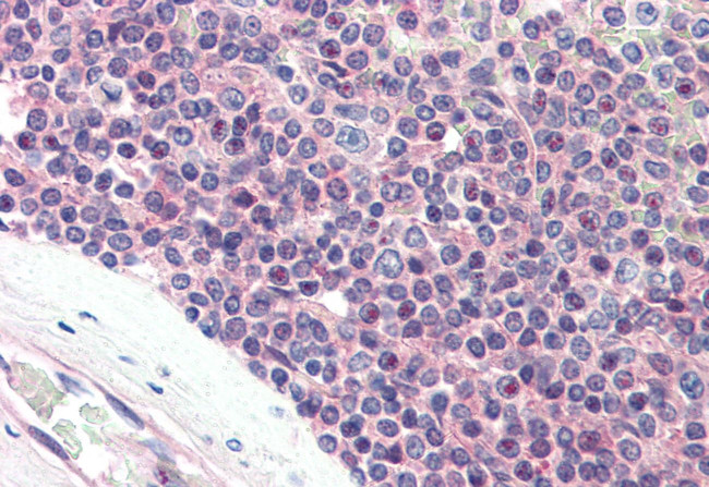 SYNGR2 Antibody in Immunohistochemistry (Paraffin) (IHC (P))