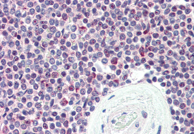 SYNGR2 Antibody in Immunohistochemistry (Paraffin) (IHC (P))