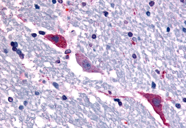 TACR3 Antibody in Immunohistochemistry (Paraffin) (IHC (P))