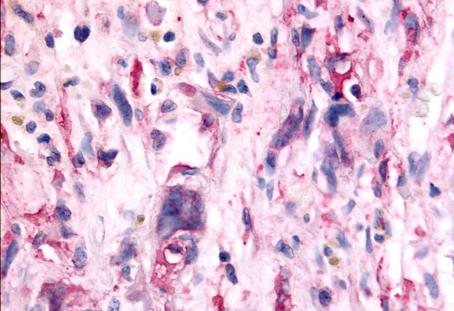 TAOK1 Antibody in Immunohistochemistry (Paraffin) (IHC (P))
