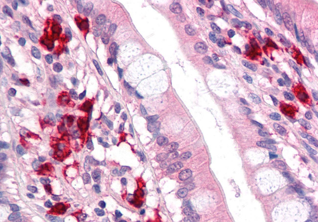TFF2 Antibody in Immunohistochemistry (Paraffin) (IHC (P))
