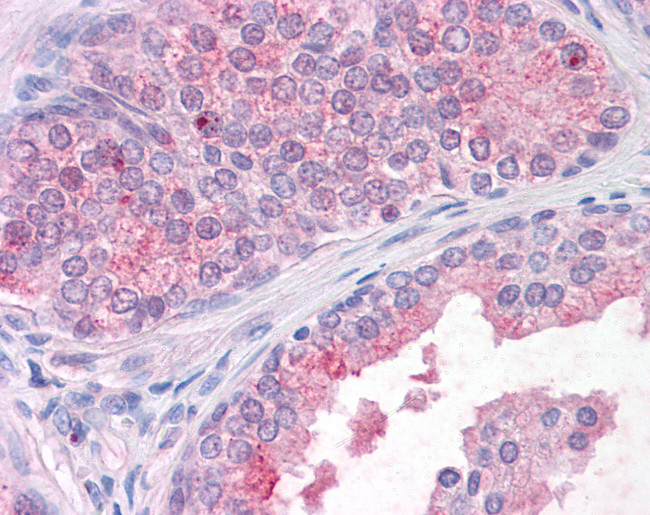 TM9SF1 Antibody in Immunohistochemistry (Paraffin) (IHC (P))