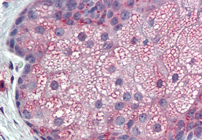 TM9SF3 Antibody in Immunohistochemistry (Paraffin) (IHC (P))