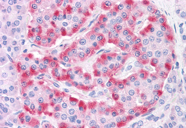 TM9SF4 Antibody in Immunohistochemistry (Paraffin) (IHC (P))
