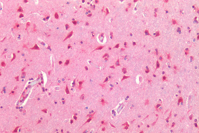 TM9SF4 Antibody in Immunohistochemistry (Paraffin) (IHC (P))