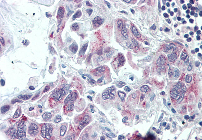 TMPRSS4 Antibody in Immunohistochemistry (Paraffin) (IHC (P))