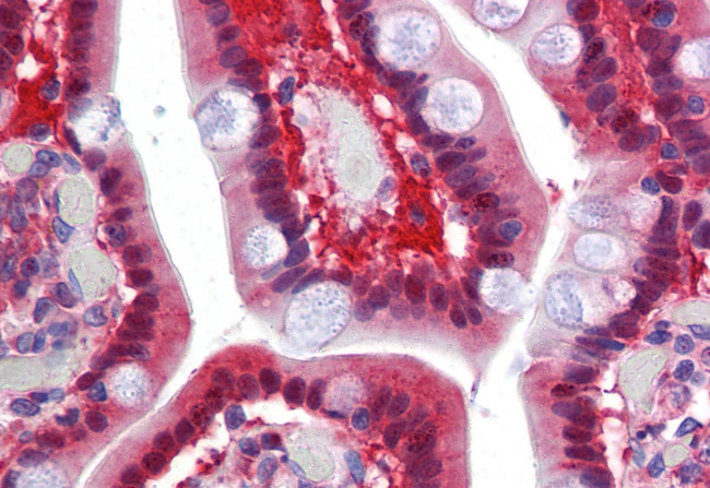 TMPRSS4 Antibody in Immunohistochemistry (Paraffin) (IHC (P))